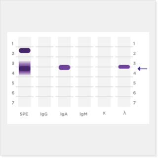 Serum immunofixation (IFE) image.